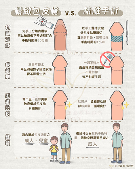 包皮槍手術與精雕包皮手術比較