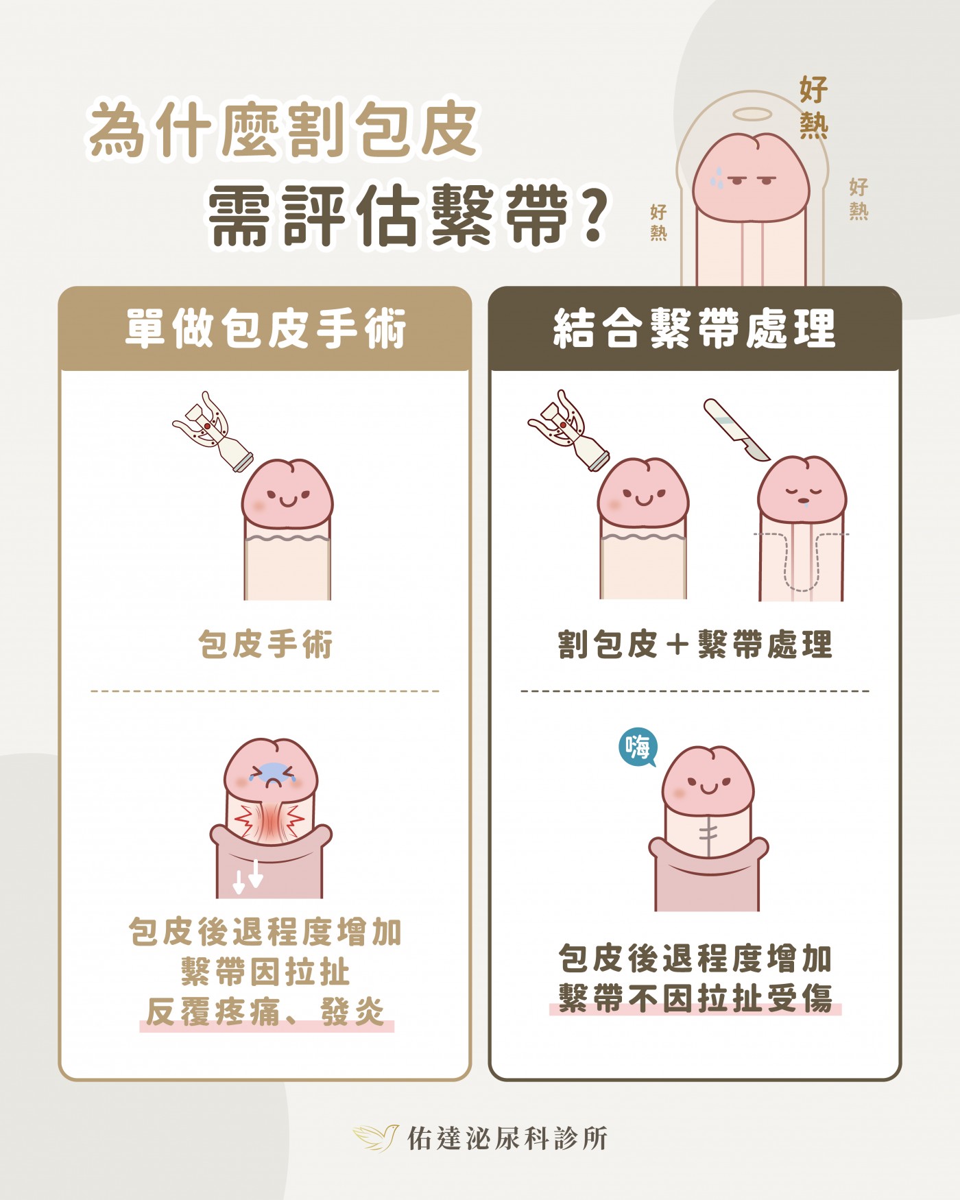 包皮繫帶位置