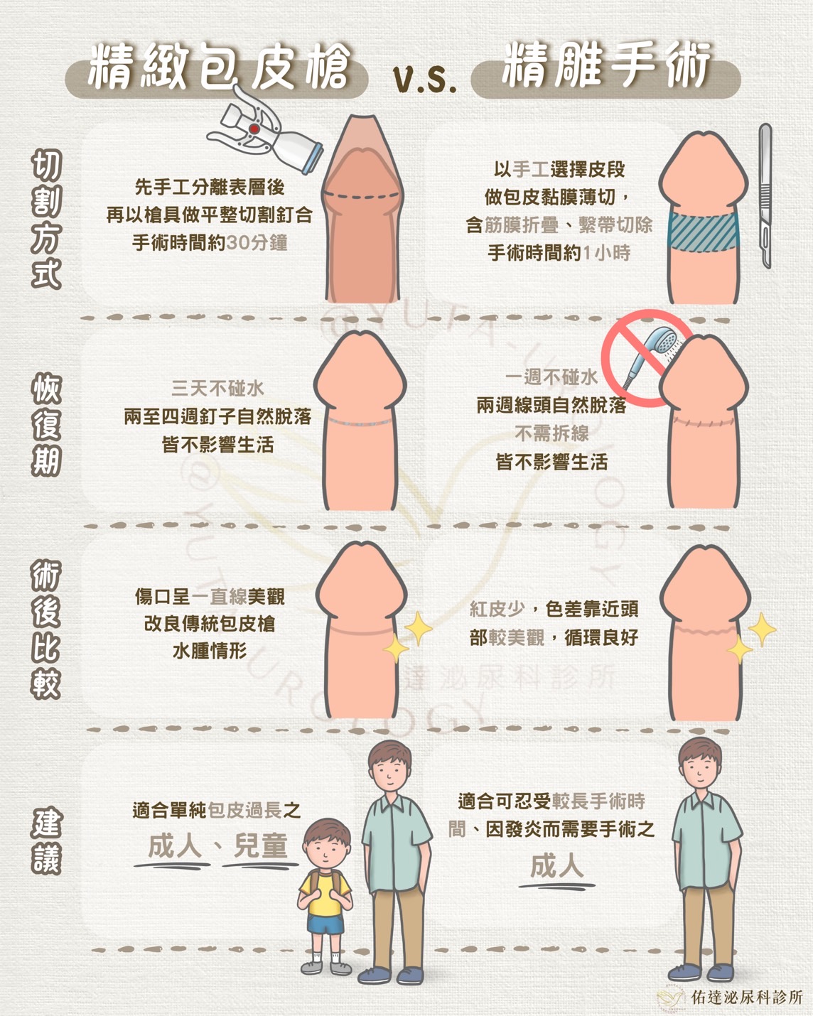 手術方式比較