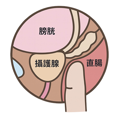 攝護腺肥大尿流速與餘尿檢查